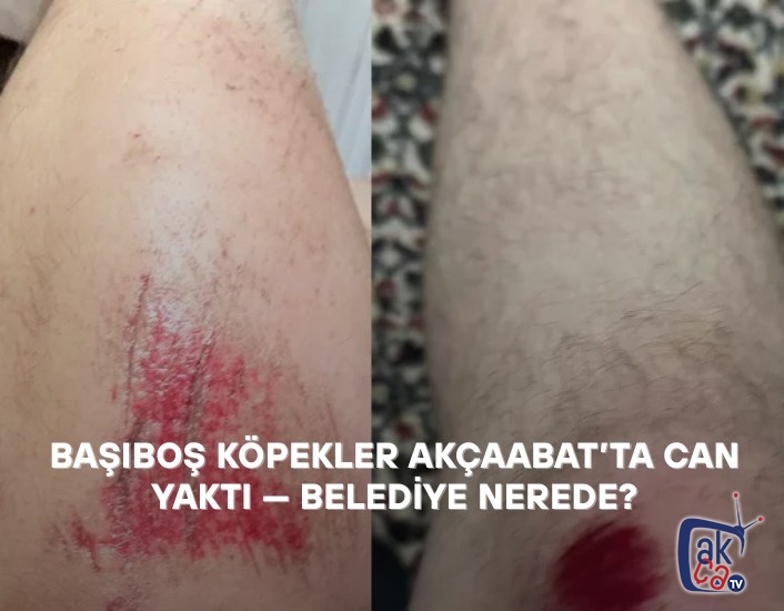BAŞIBOŞ KÖPEKLER AKÇAABAT’TA CAN YAKTI — BELEDİYE NEREDE?