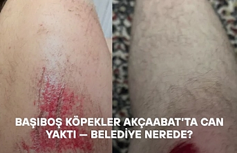 BAŞIBOŞ KÖPEKLER AKÇAABAT’TA CAN YAKTI — BELEDİYE NEREDE?