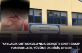 YAYLACIK ORTAOKULU'NDA DEHŞET: SINIFI BASIP YUMRUKLADI, YÜZÜNE 25 DİKİŞ ATILDI!
