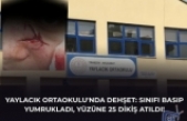 YAYLACIK ORTAOKULU'NDA DEHŞET: SINIFI BASIP YUMRUKLADI, YÜZÜNE 25 DİKİŞ ATILDI!