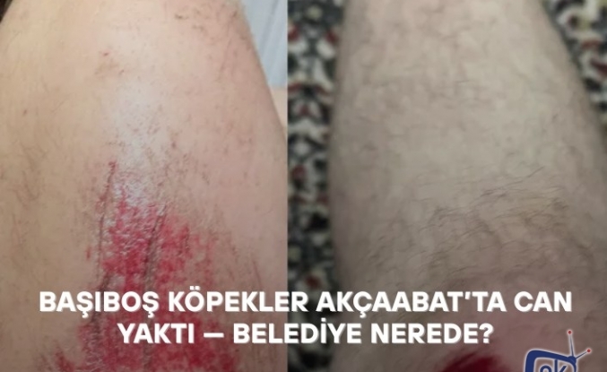 BAŞIBOŞ KÖPEKLER AKÇAABAT’TA CAN YAKTI — BELEDİYE NEREDE?