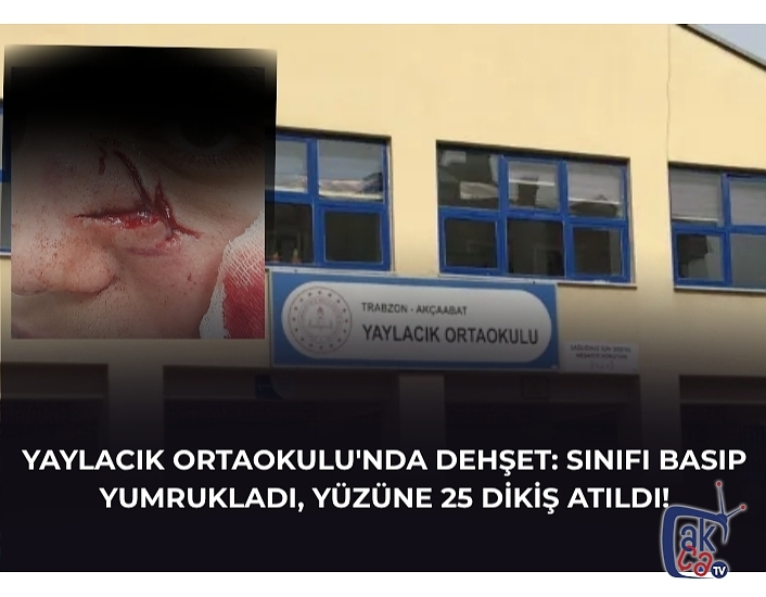 YAYLACIK ORTAOKULU'NDA DEHŞET: SINIFI BASIP YUMRUKLADI, YÜZÜNE 25 DİKİŞ ATILDI!